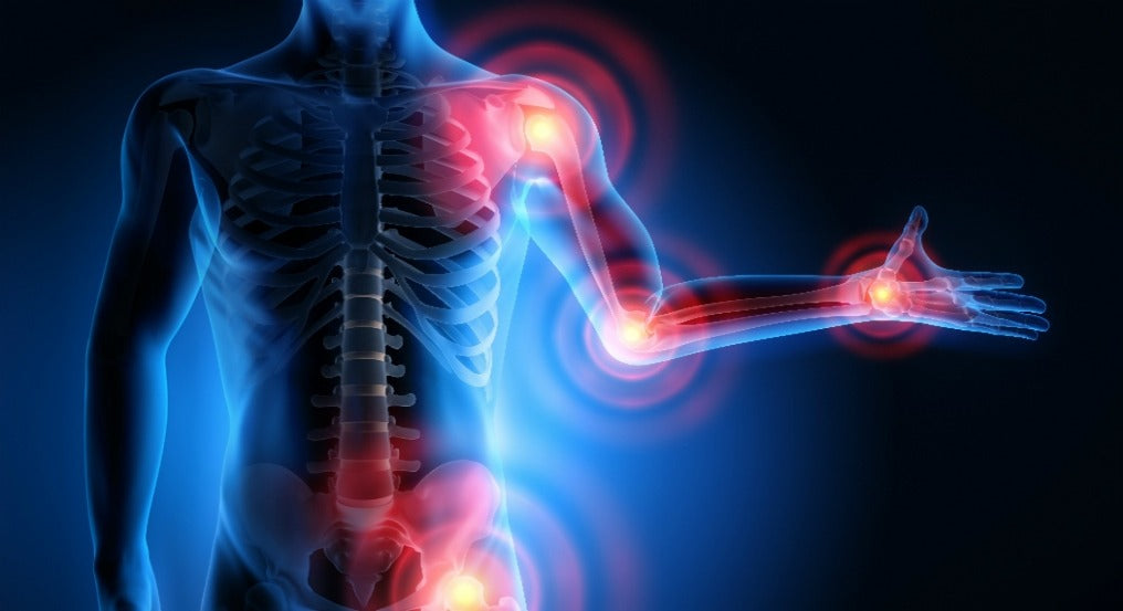 Image of a human body with MSK symptoms marks