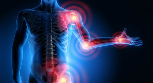 Image of a human body with MSK symptoms marks